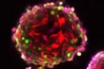 Fluorescence microscopy image of a skin cell spheroid from the Lynch Lab at King's College London