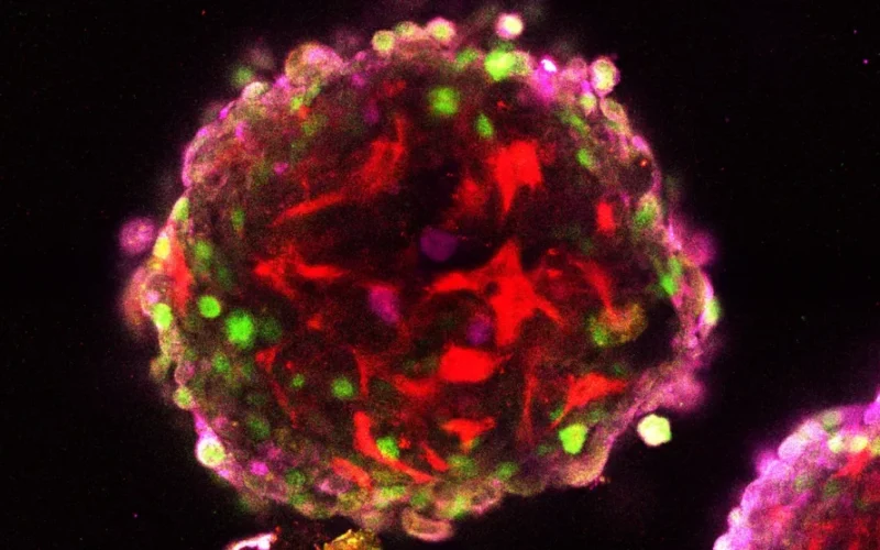 Fluorescence microscopy image of a skin cell spheroid from the Lynch Lab at King's College London