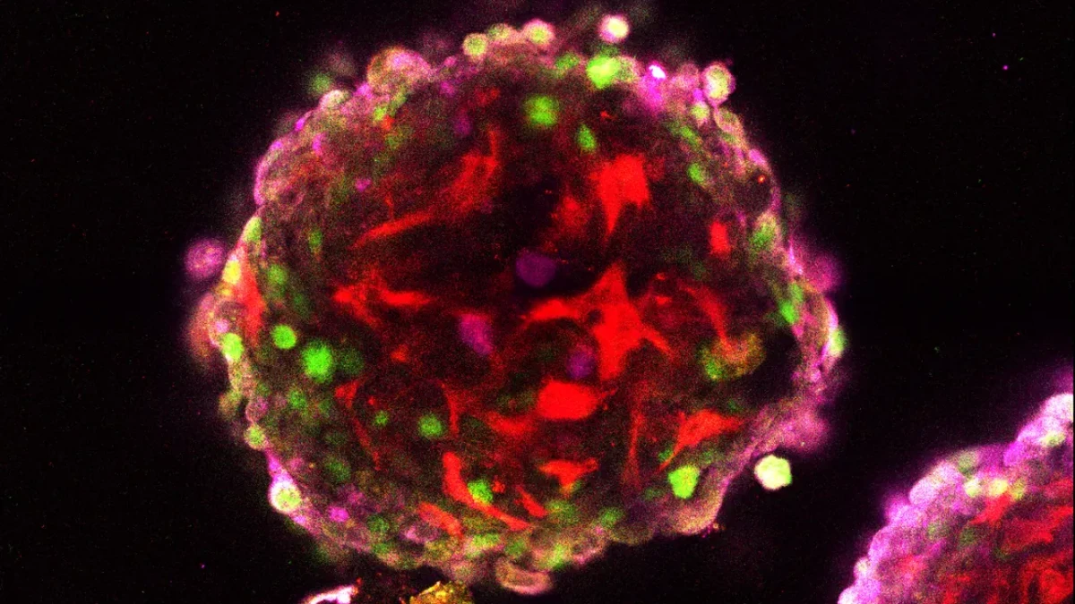 Fluorescence microscopy image of a skin cell spheroid from the Lynch Lab at King's College London